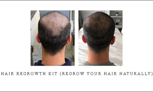 Hair regrowth kit (regrow your hair naturally)